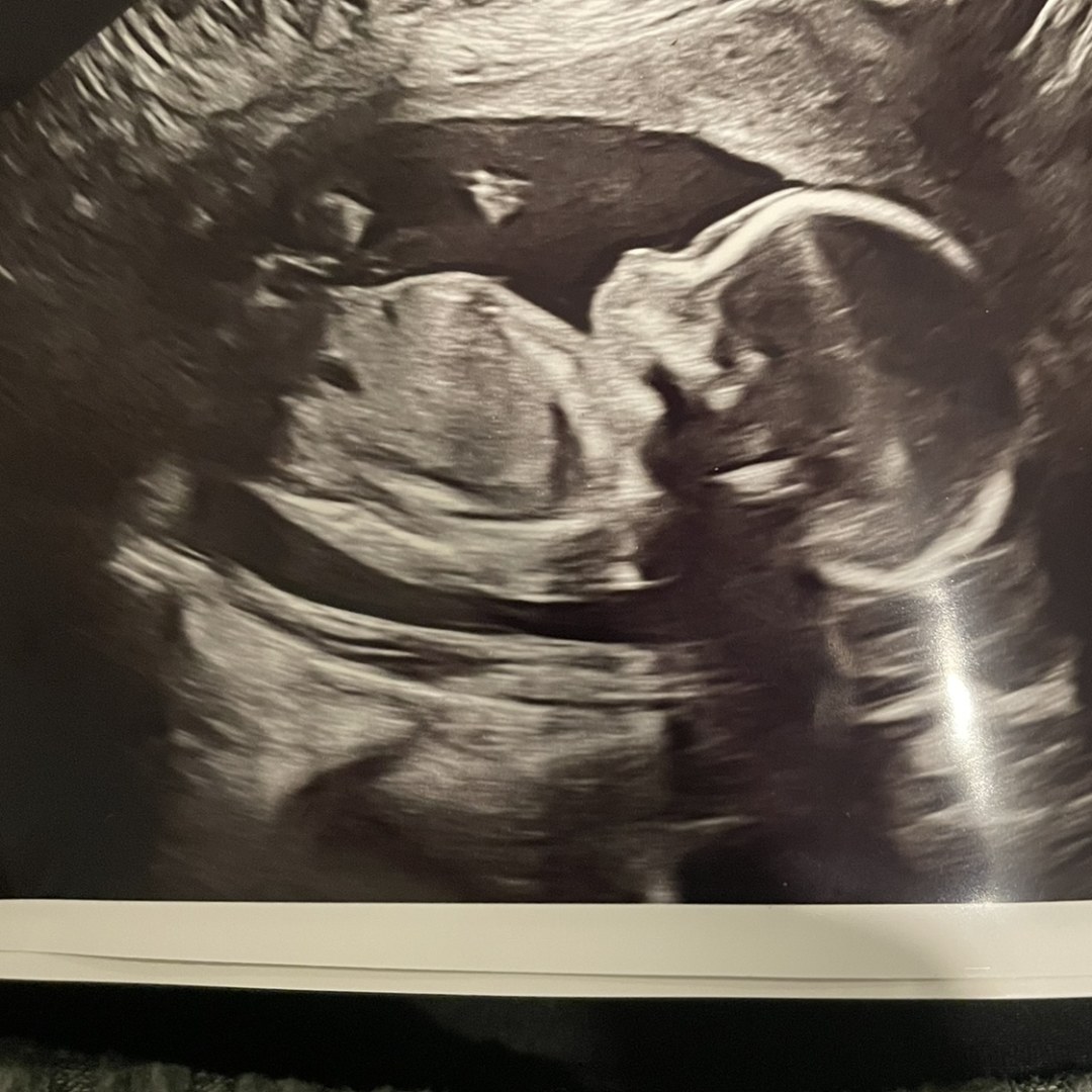 Photo shared by Chelsea for their Babylist baby registry.