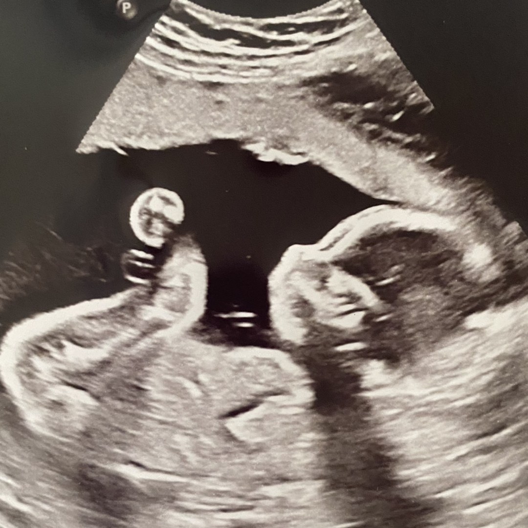 Photo shared by Laura for their Babylist baby registry.