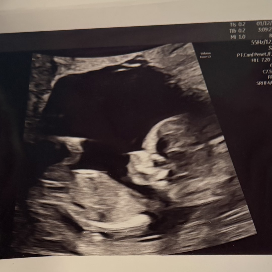 Photo shared by Kelli for their Babylist baby registry.