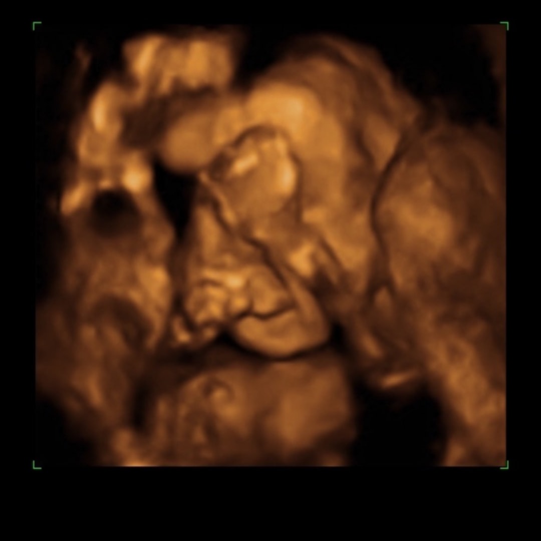 Photo shared by Stefany for their Babylist baby registry.