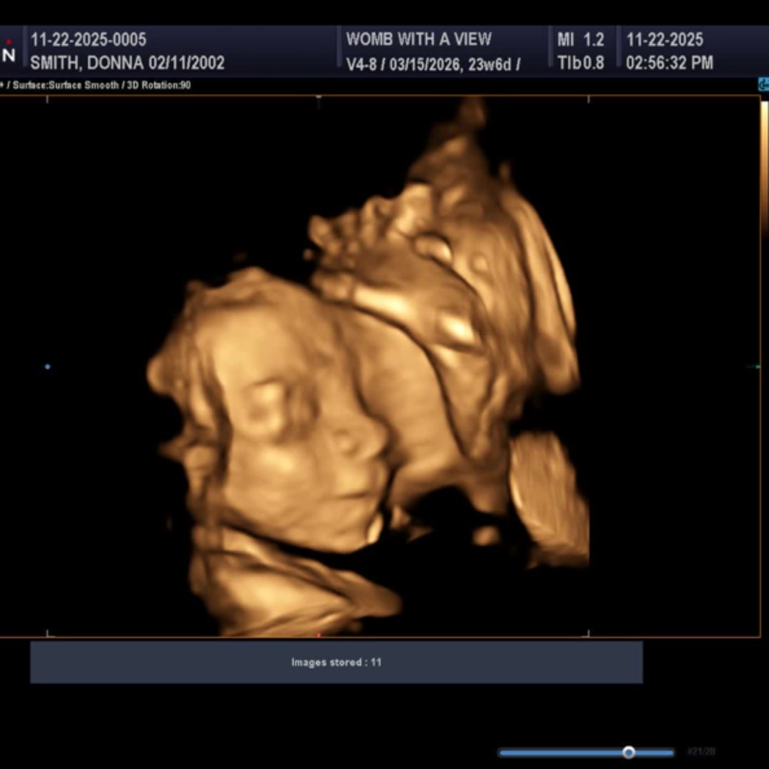 Photo shared by Donna for their Babylist baby registry.