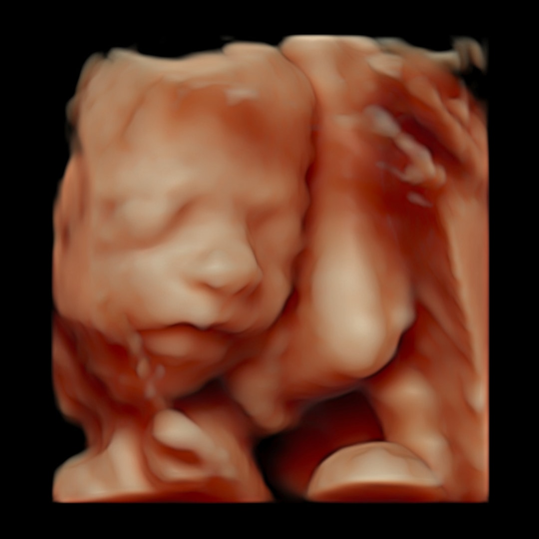 Photo shared by Mary & Kris for their Babylist baby registry.
