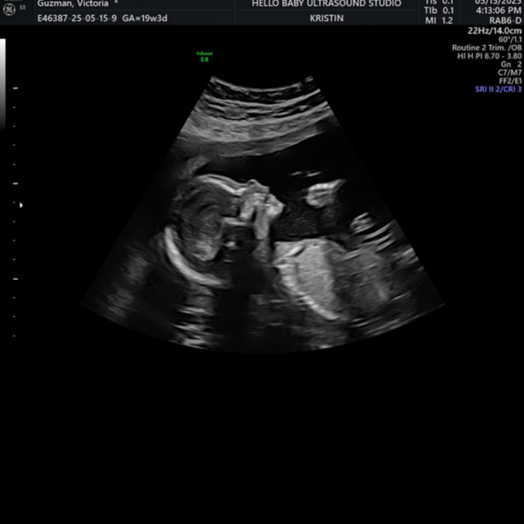Photo shared by Victoria for their Babylist baby registry.