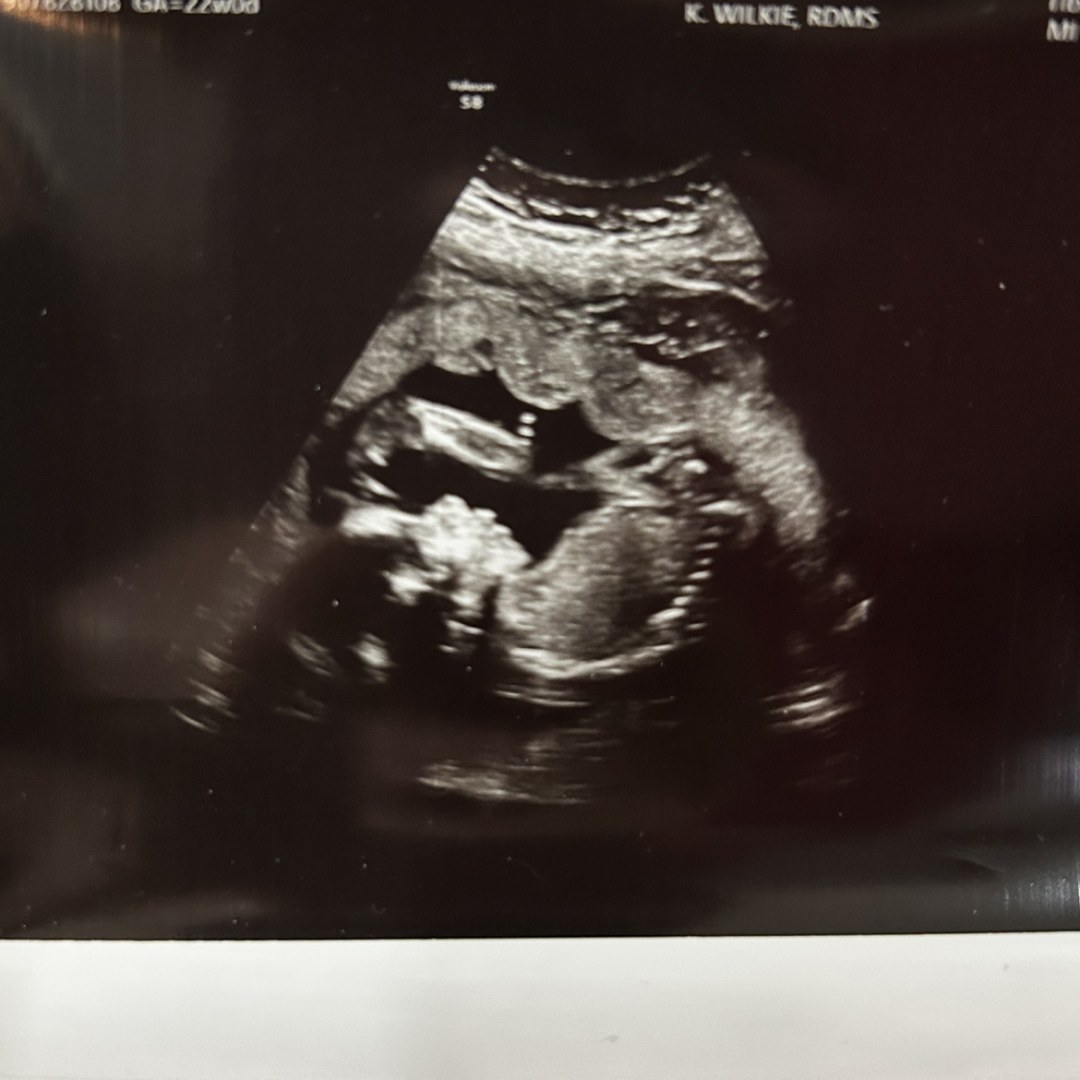 Photo shared by Lindsey for their Babylist baby registry.