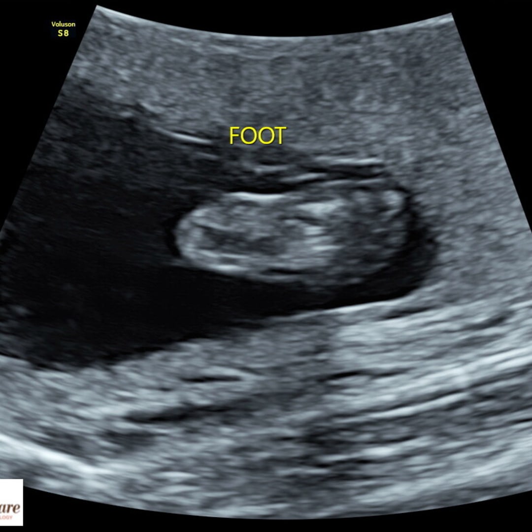 Photo shared by Ariel for their Babylist baby registry.