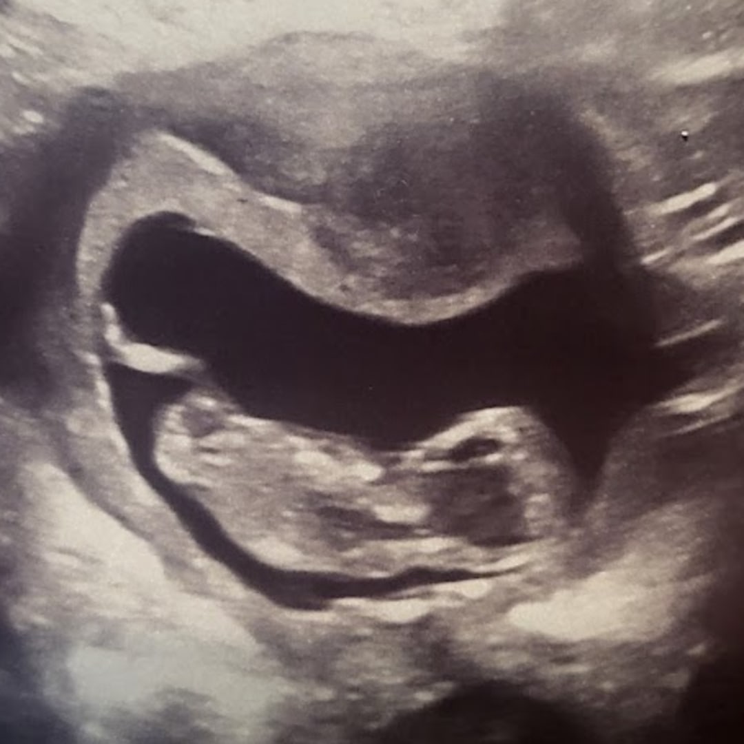 Photo shared by Heather for their Babylist baby registry.