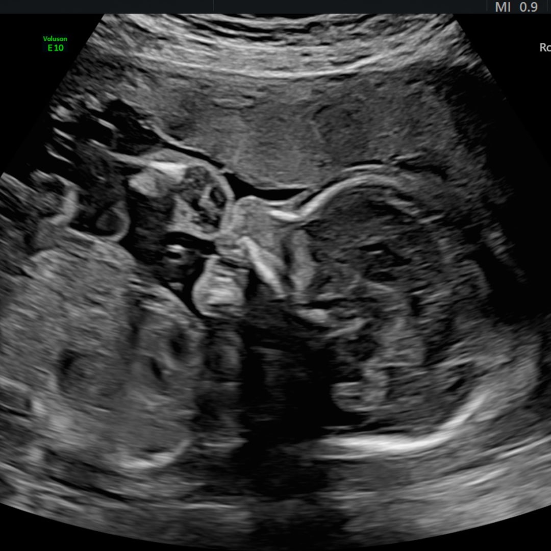 Photo shared by Trinity for their Babylist baby registry.