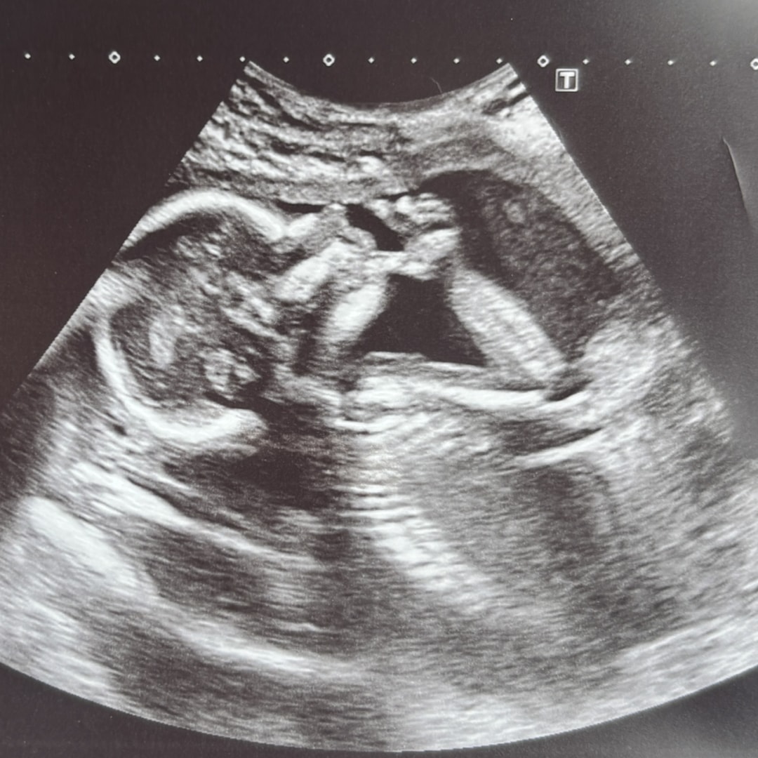 Photo shared by Jordan for their Babylist baby registry.