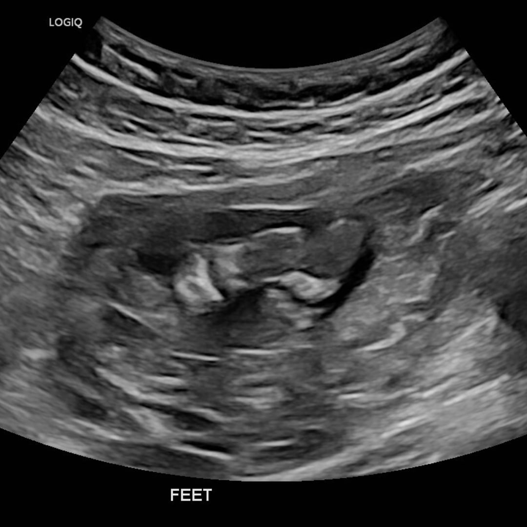 Photo shared by Allison for their Babylist baby registry.