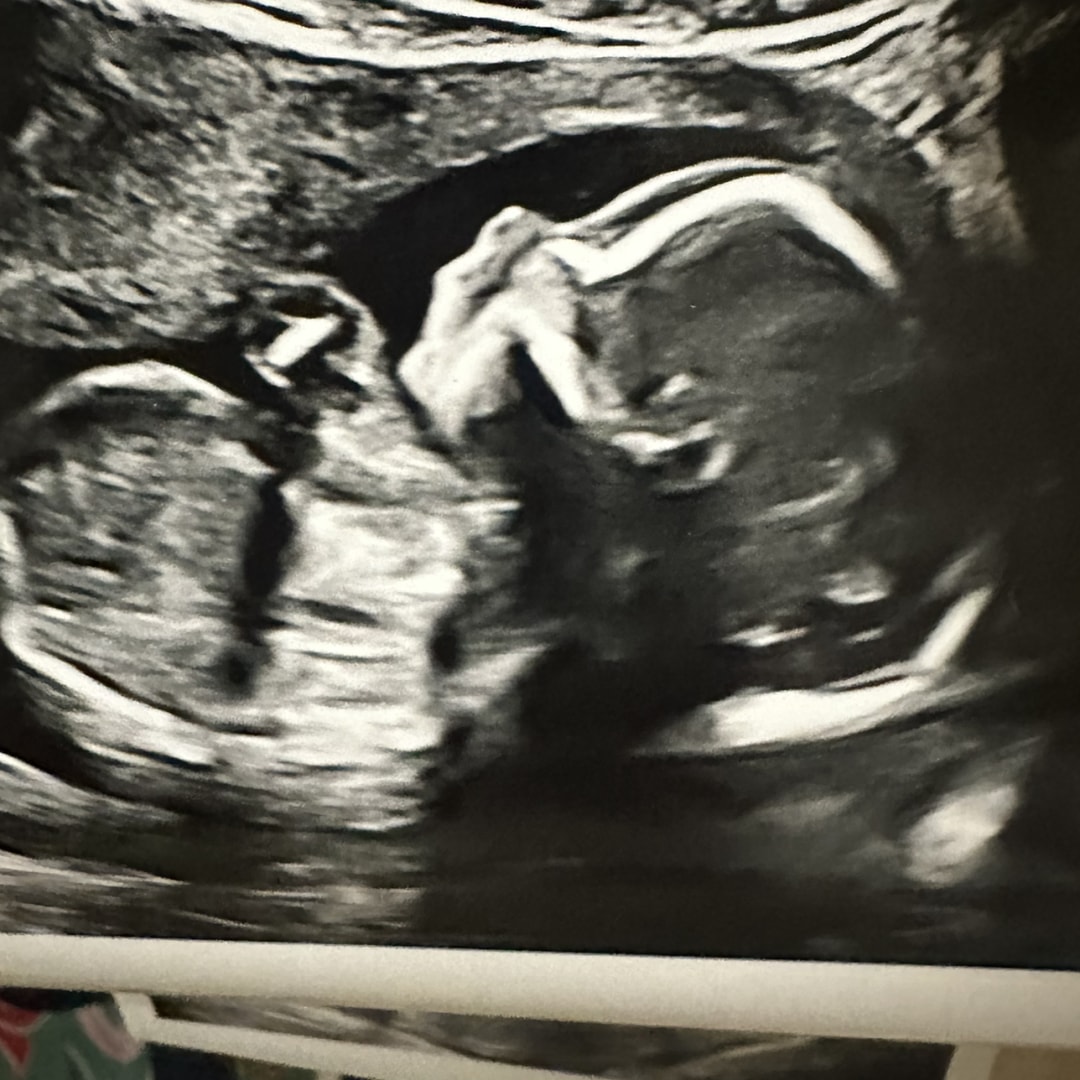 Photo shared by Francesca for their Babylist baby registry.