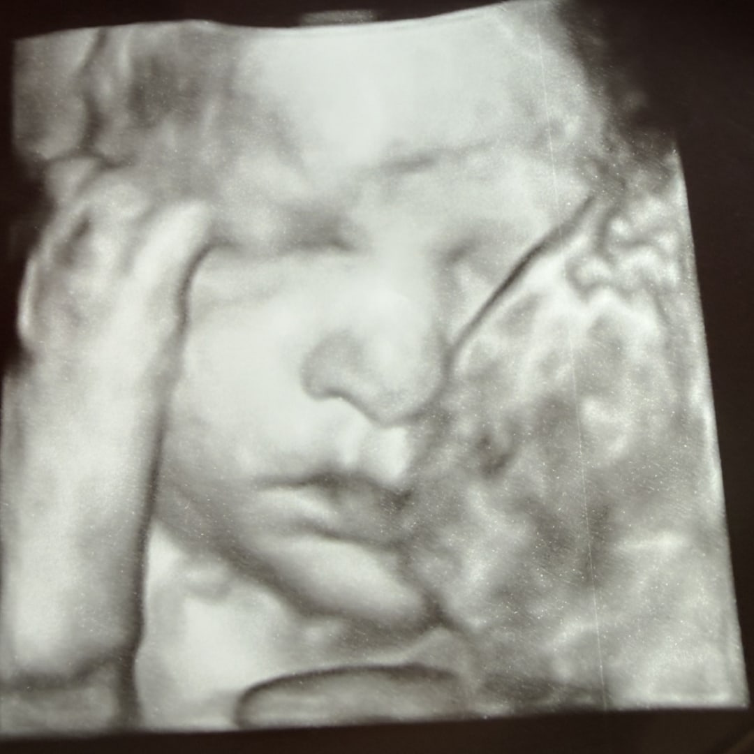 Photo shared by Cherice for their Babylist baby registry.