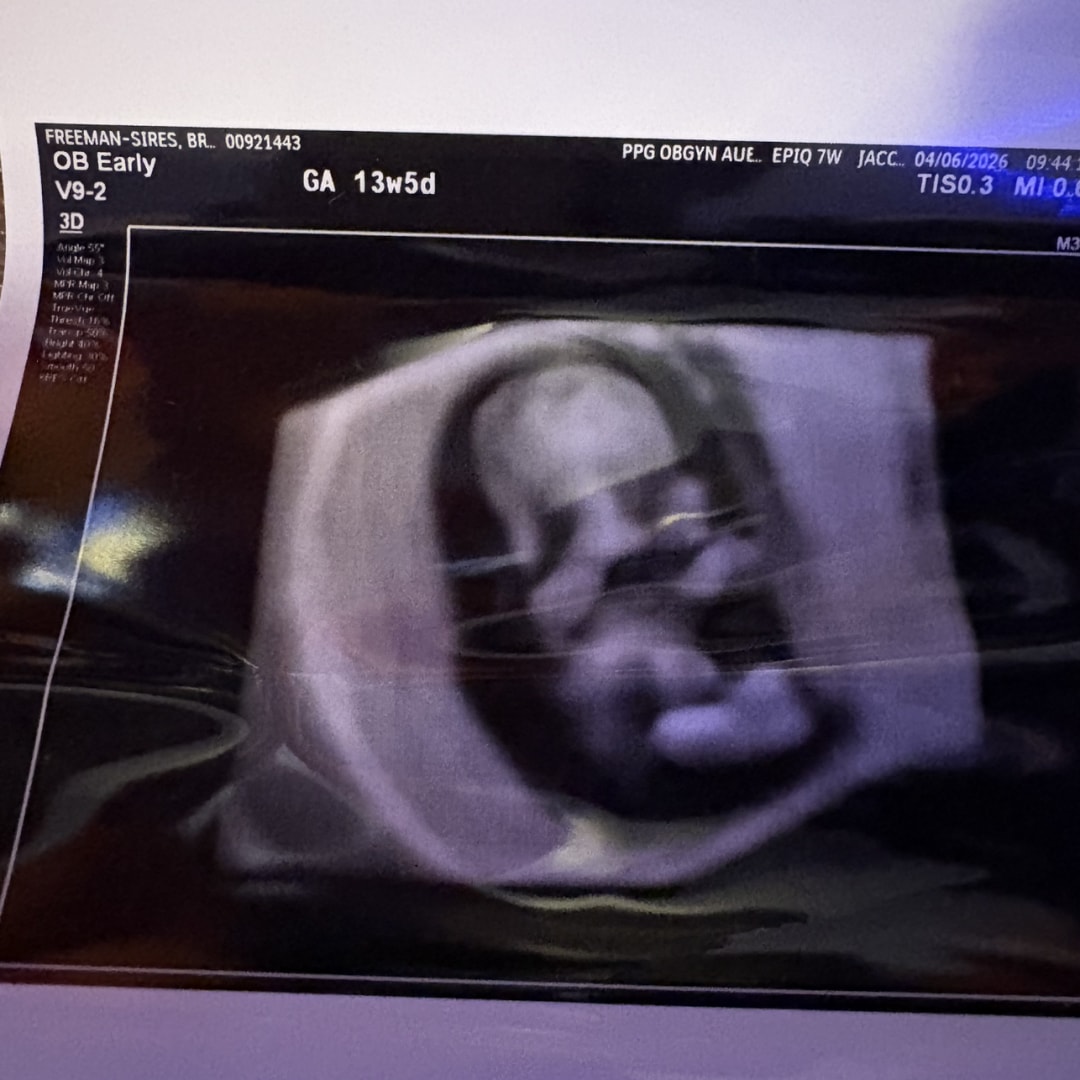 Photo shared by Braelynn for their Babylist baby registry.
