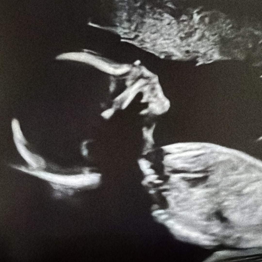 Photo shared by Michelle for their Babylist baby registry.