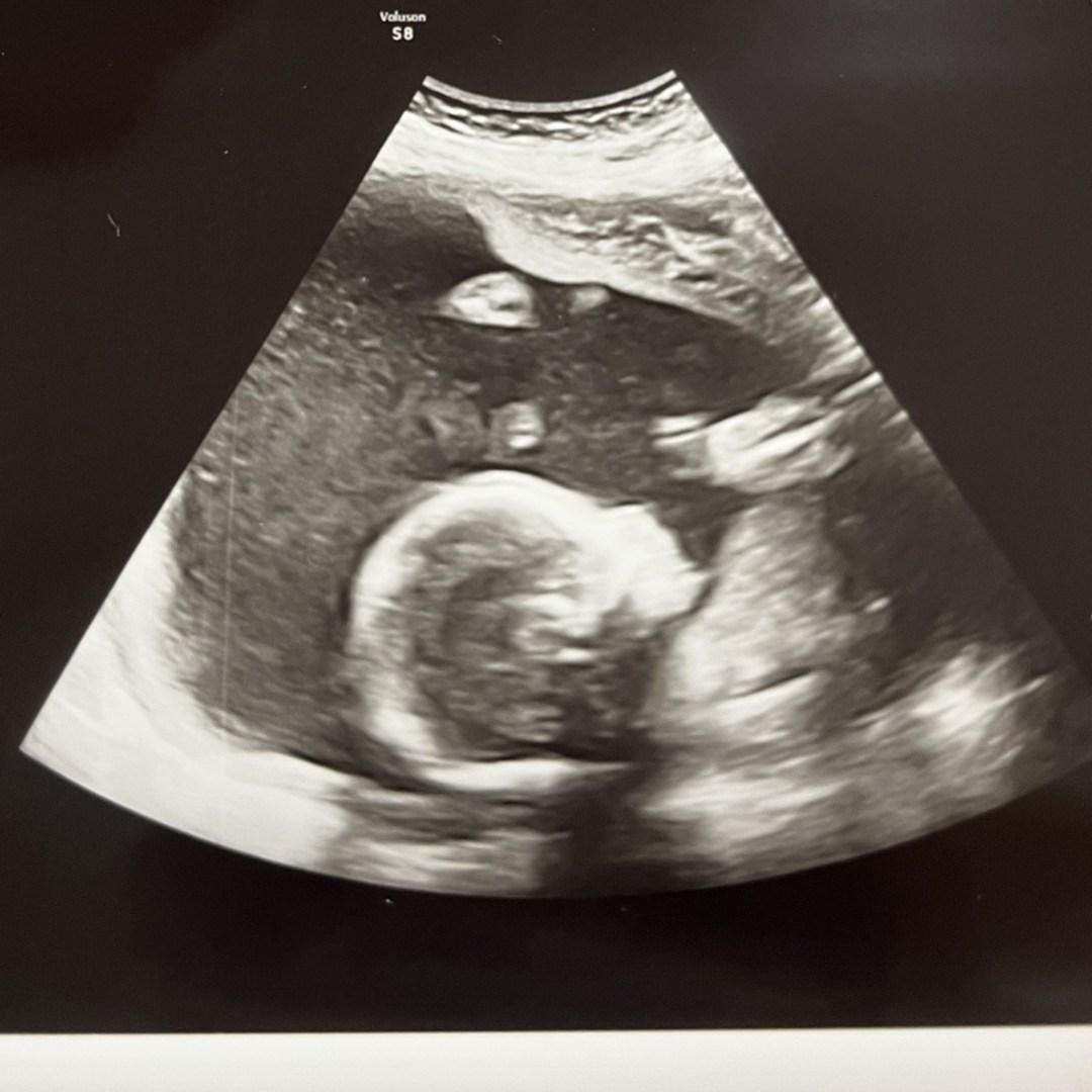 Photo shared by Sarah for their Babylist baby registry.