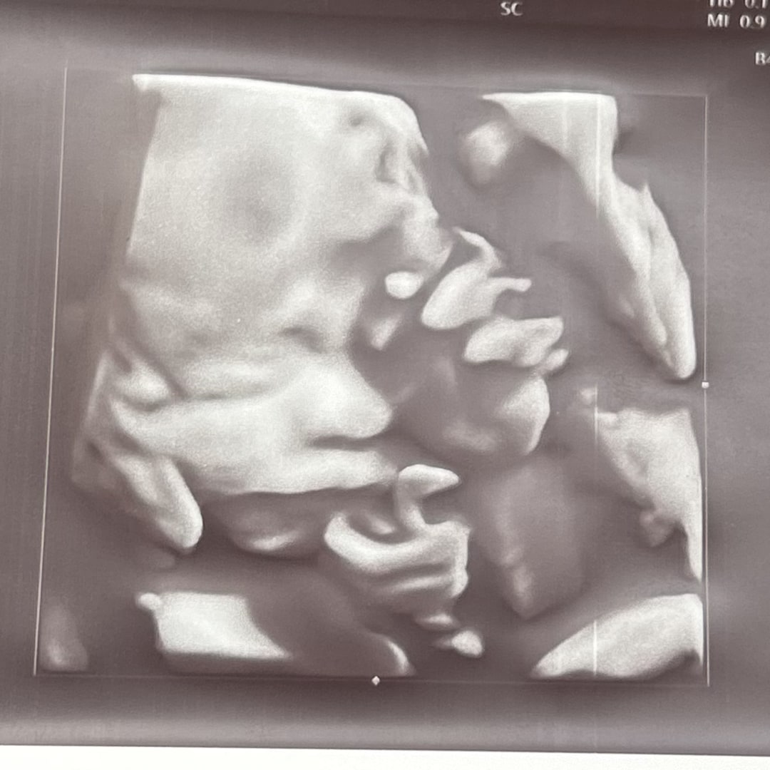 Photo shared by Arlene for their Babylist baby registry.