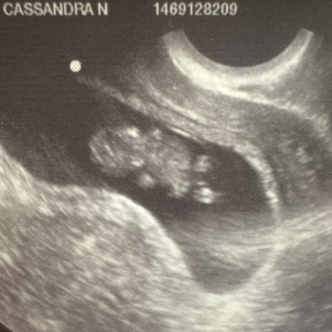 Photo shared by Cassie for their Babylist baby registry.