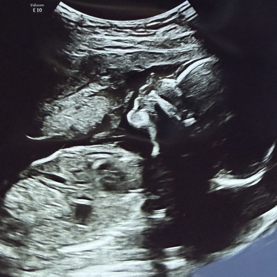 Photo shared by Ellie for their Babylist baby registry.