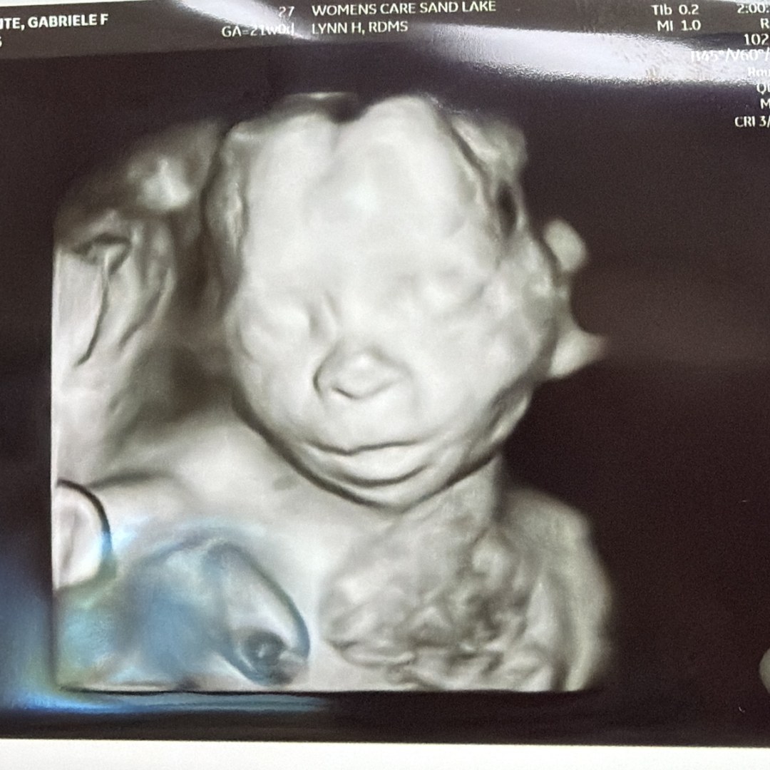 Photo shared by Gabriele for their Babylist baby registry.