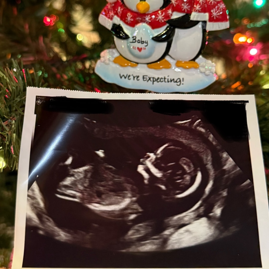 Photo shared by Chelsea for their Babylist baby registry.