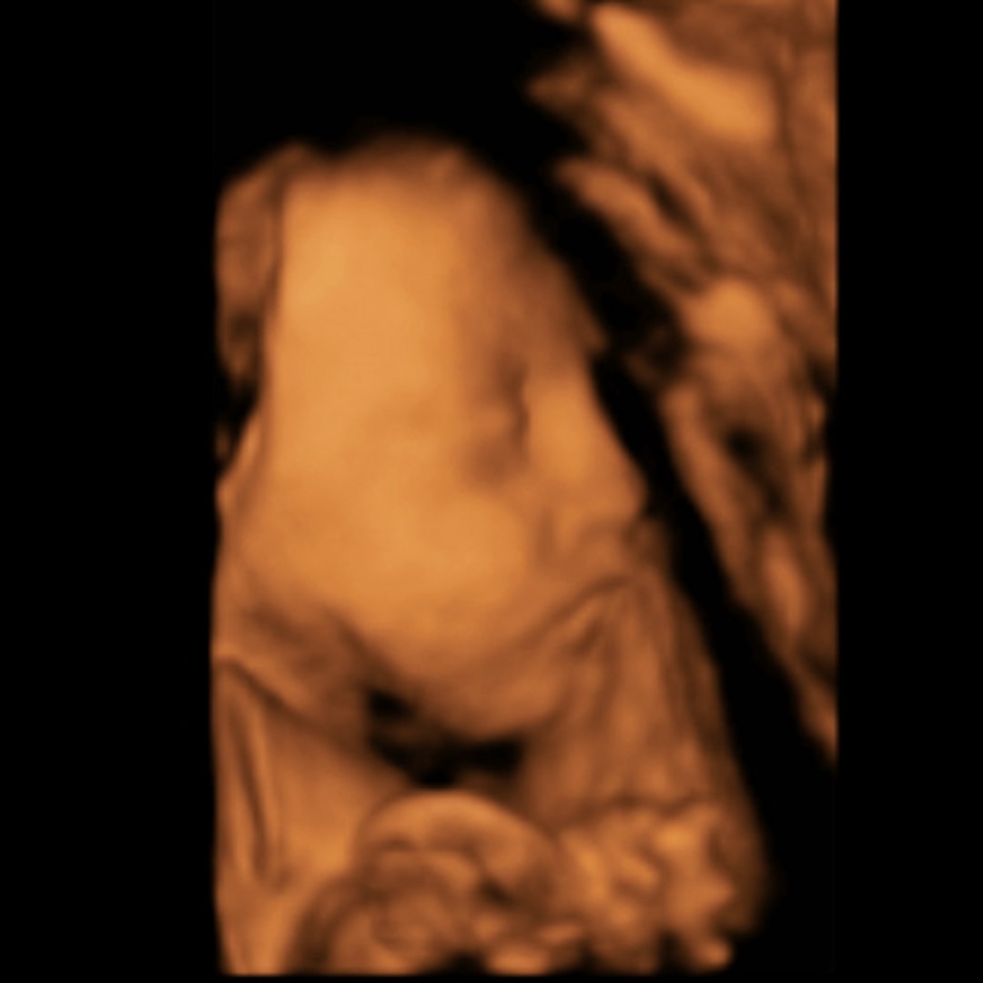 Photo shared by Hannah for their Babylist baby registry.