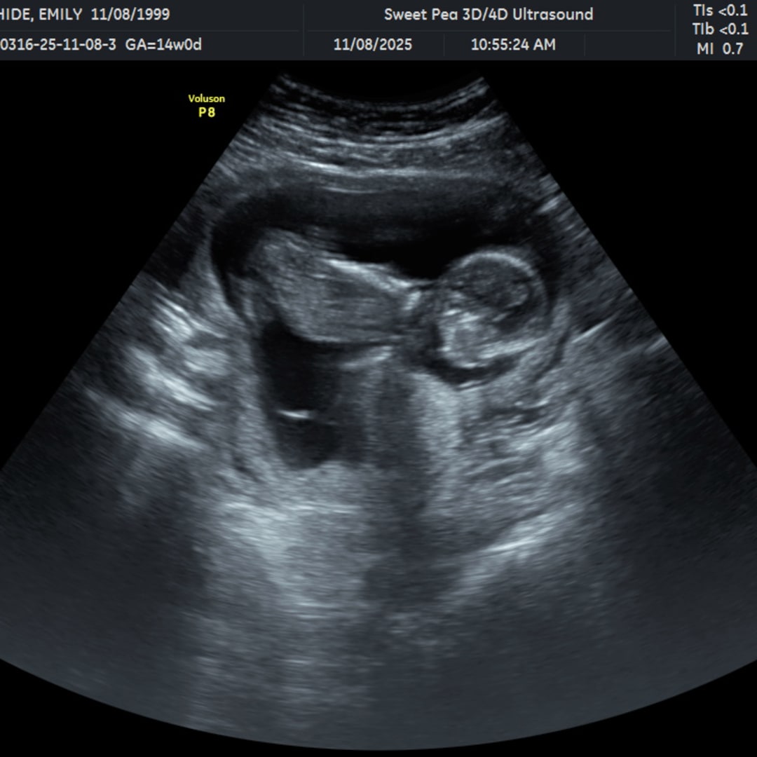 Photo shared by Emily for their Babylist baby registry.