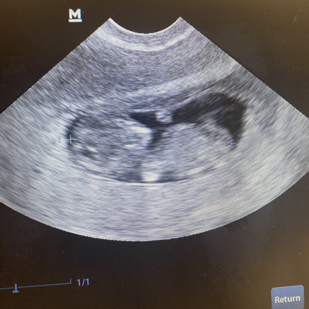 Photo shared by Deana for their Babylist baby registry.