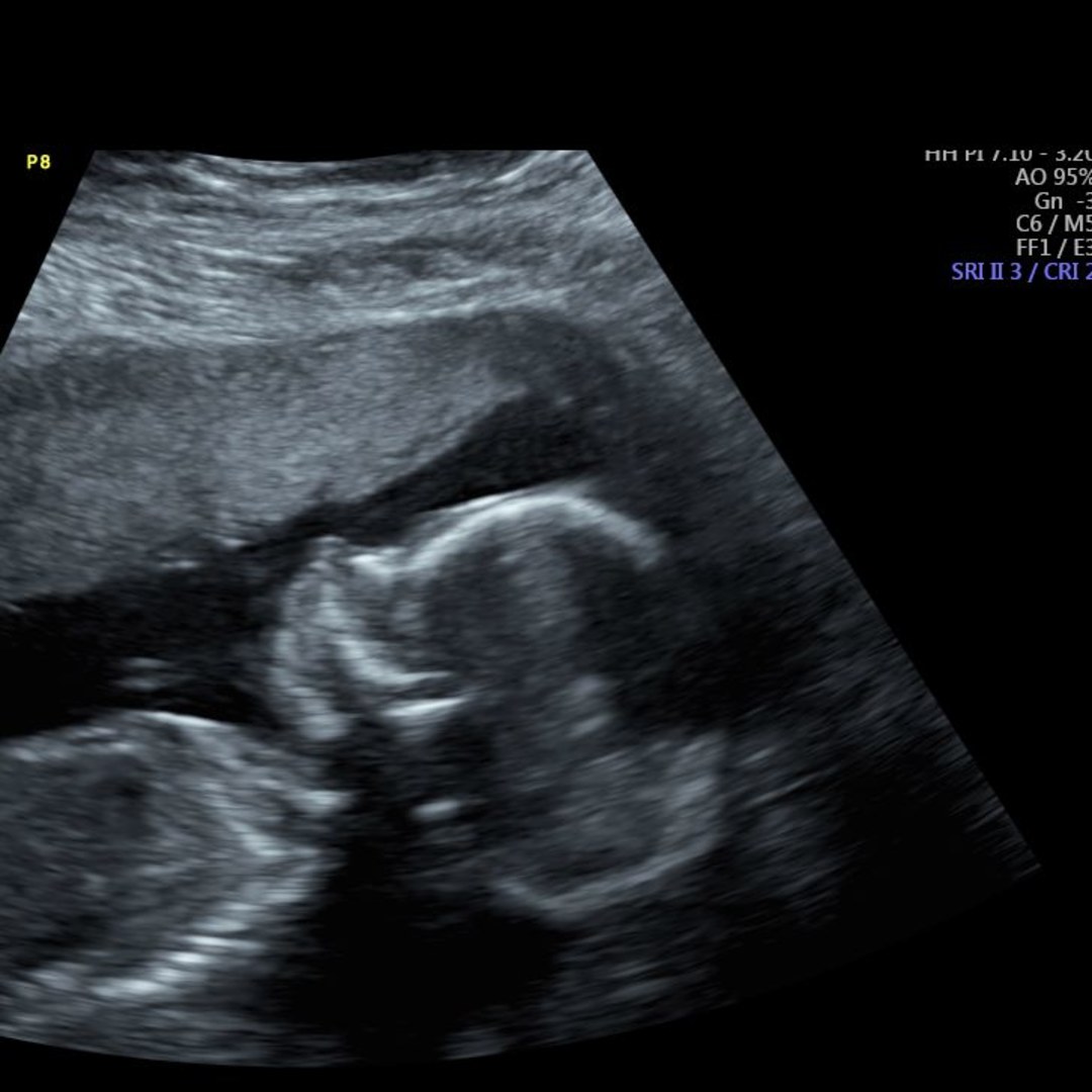 Photo shared by Samantha for their Babylist baby registry.