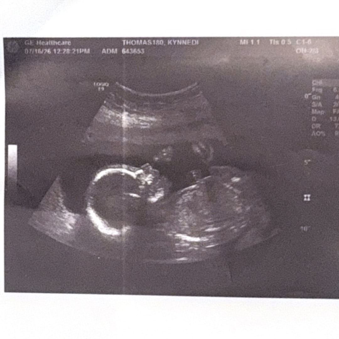 Photo shared by McKenzie for their Babylist baby registry.