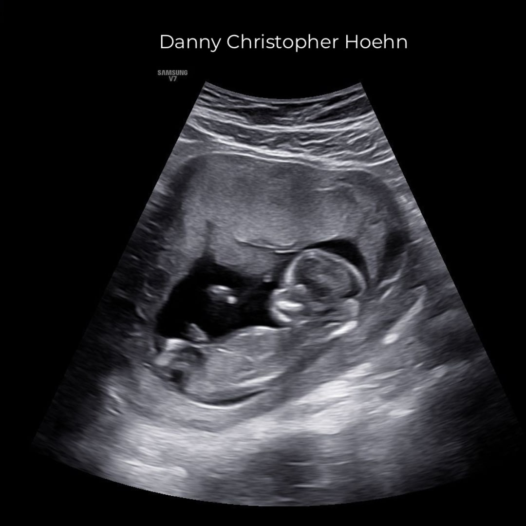 Photo shared by Sydney for their Babylist baby registry.
