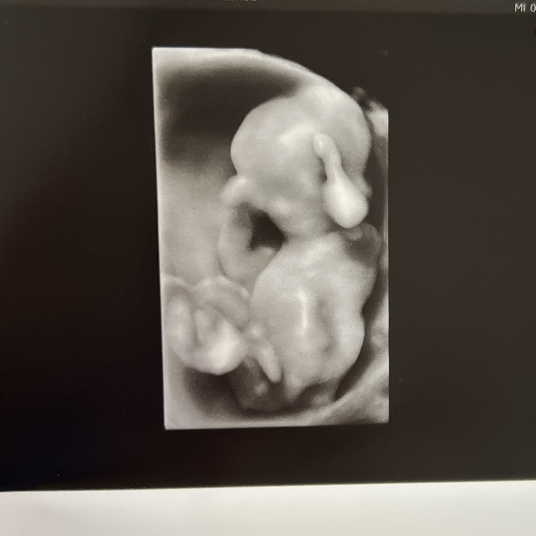 Photo shared by Dena for their Babylist baby registry.