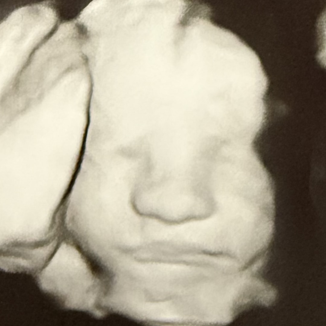 Photo shared by Lindsey for their Babylist baby registry.