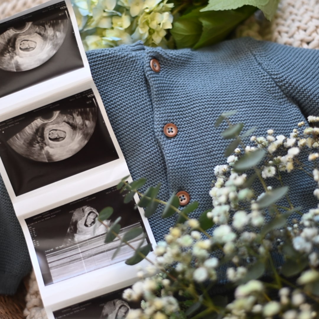 Photo shared by Julia for their Babylist baby registry.