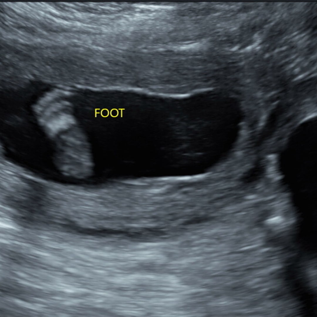 Photo shared by Ash for their Babylist baby registry.