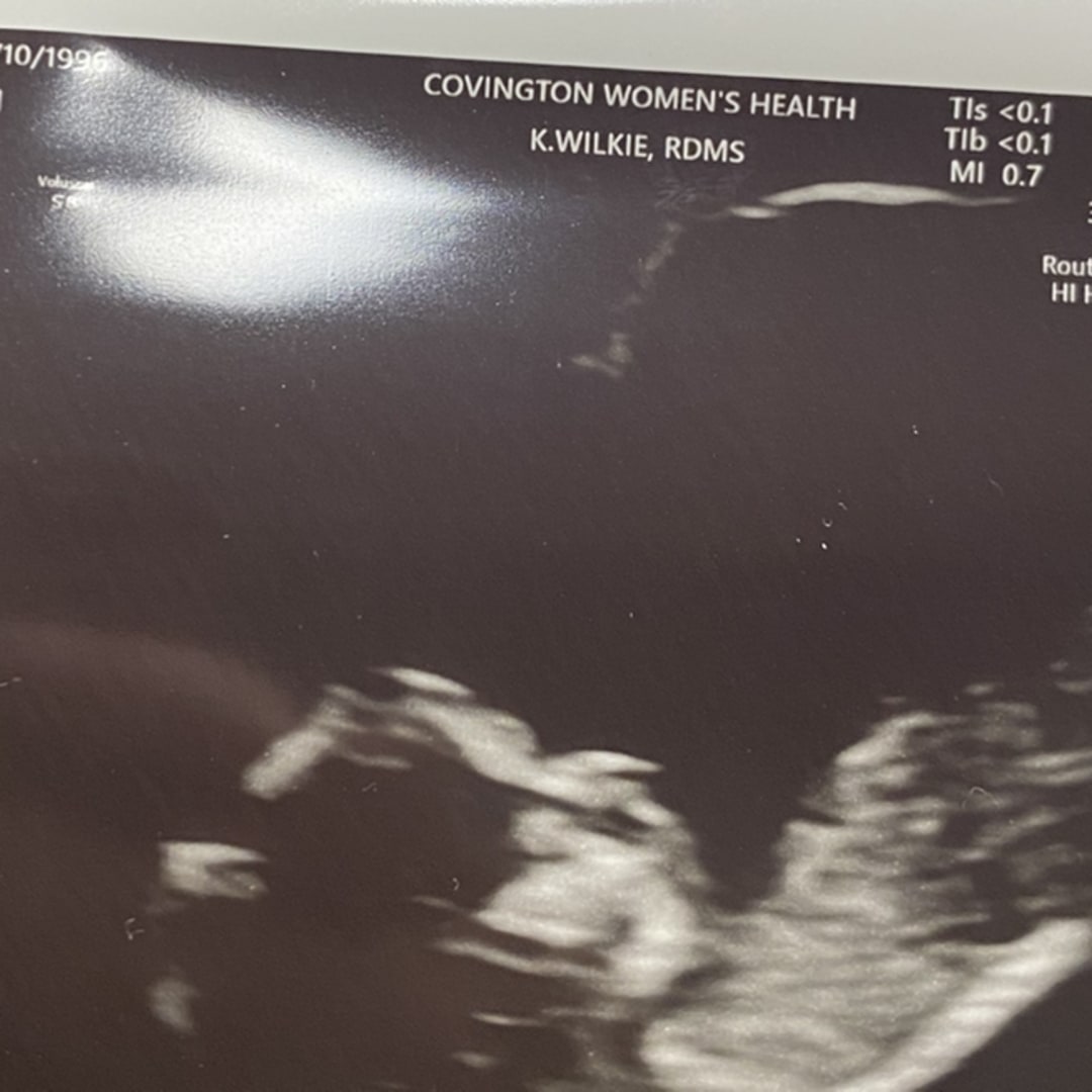 Photo shared by Tayler for their Babylist baby registry.