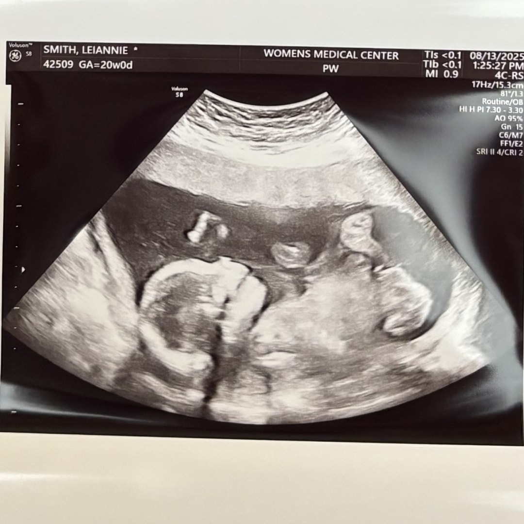 Photo shared by Leiannie for their Babylist baby registry.