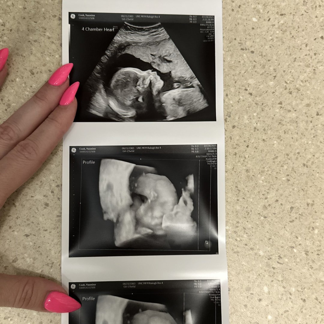 Photo shared by Yasmine for their Babylist baby registry.