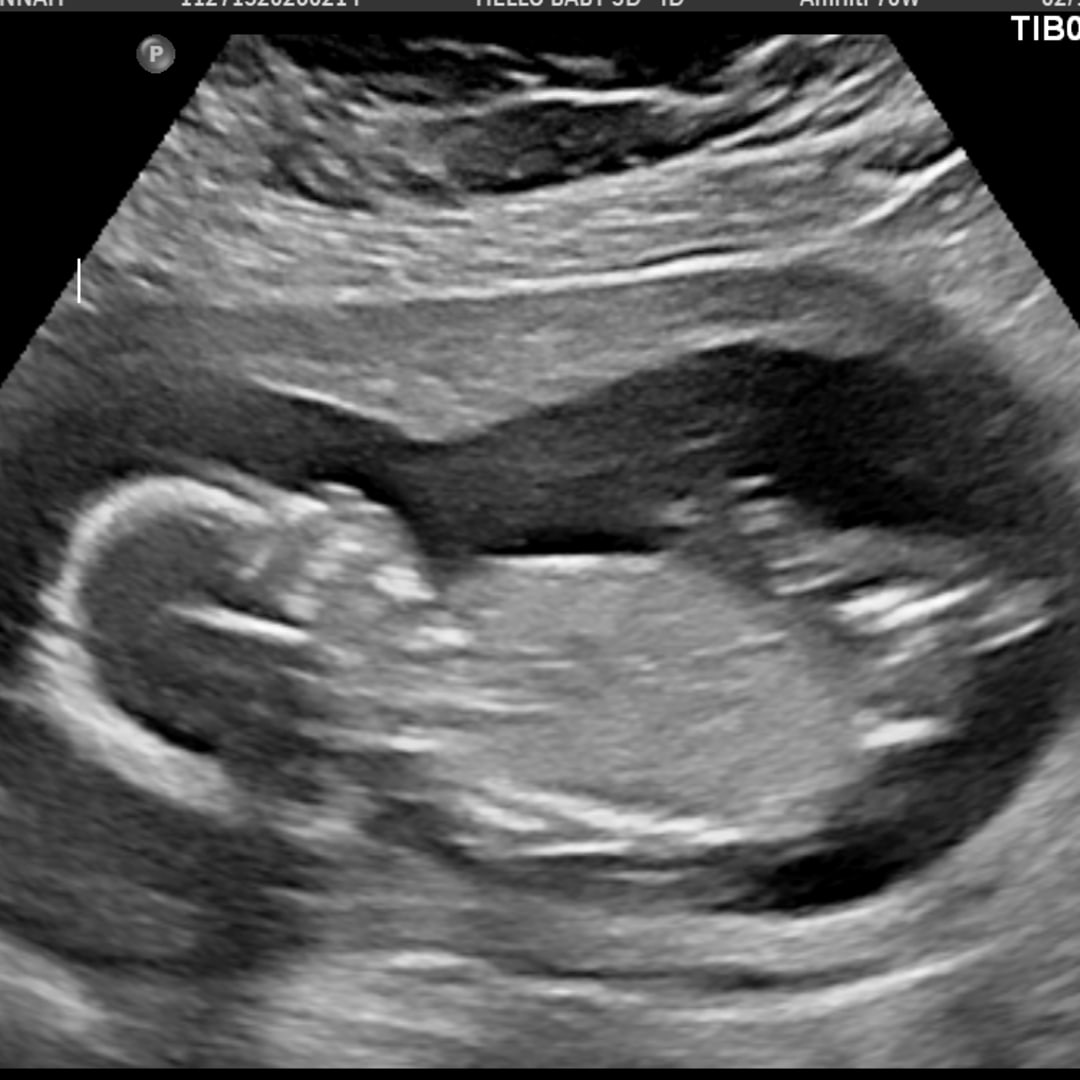 Photo shared by Hannah for their Babylist baby registry.