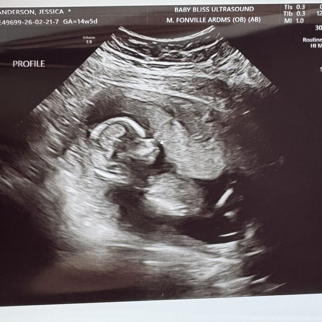 Photo shared by Jessica for their Babylist baby registry.