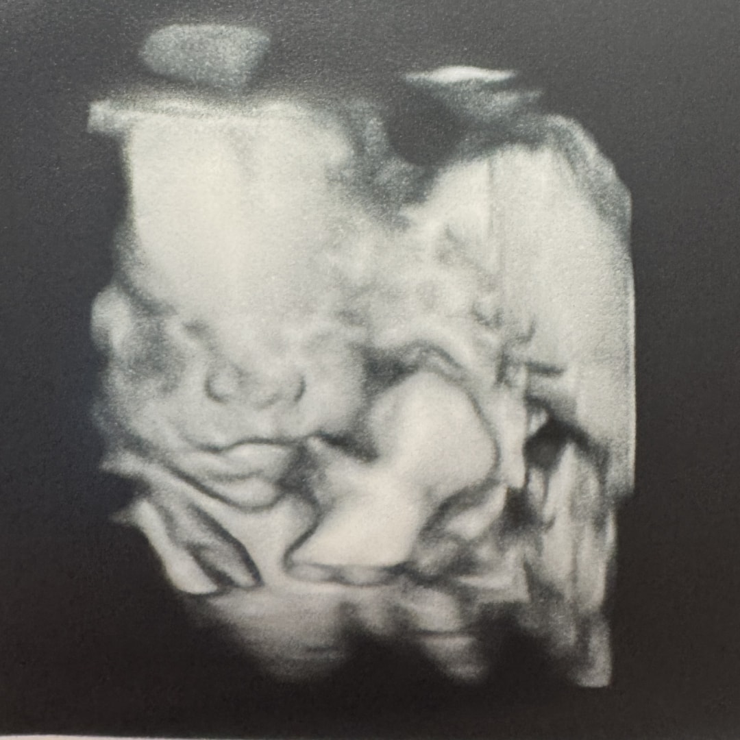 Photo shared by Morgan for their Babylist baby registry.