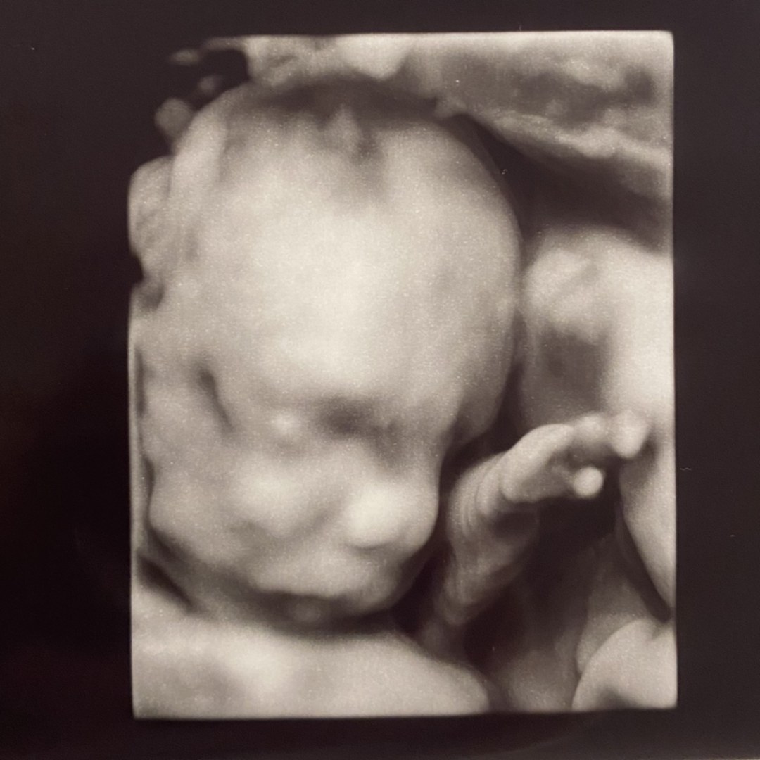 Photo shared by Ashtyn for their Babylist baby registry.