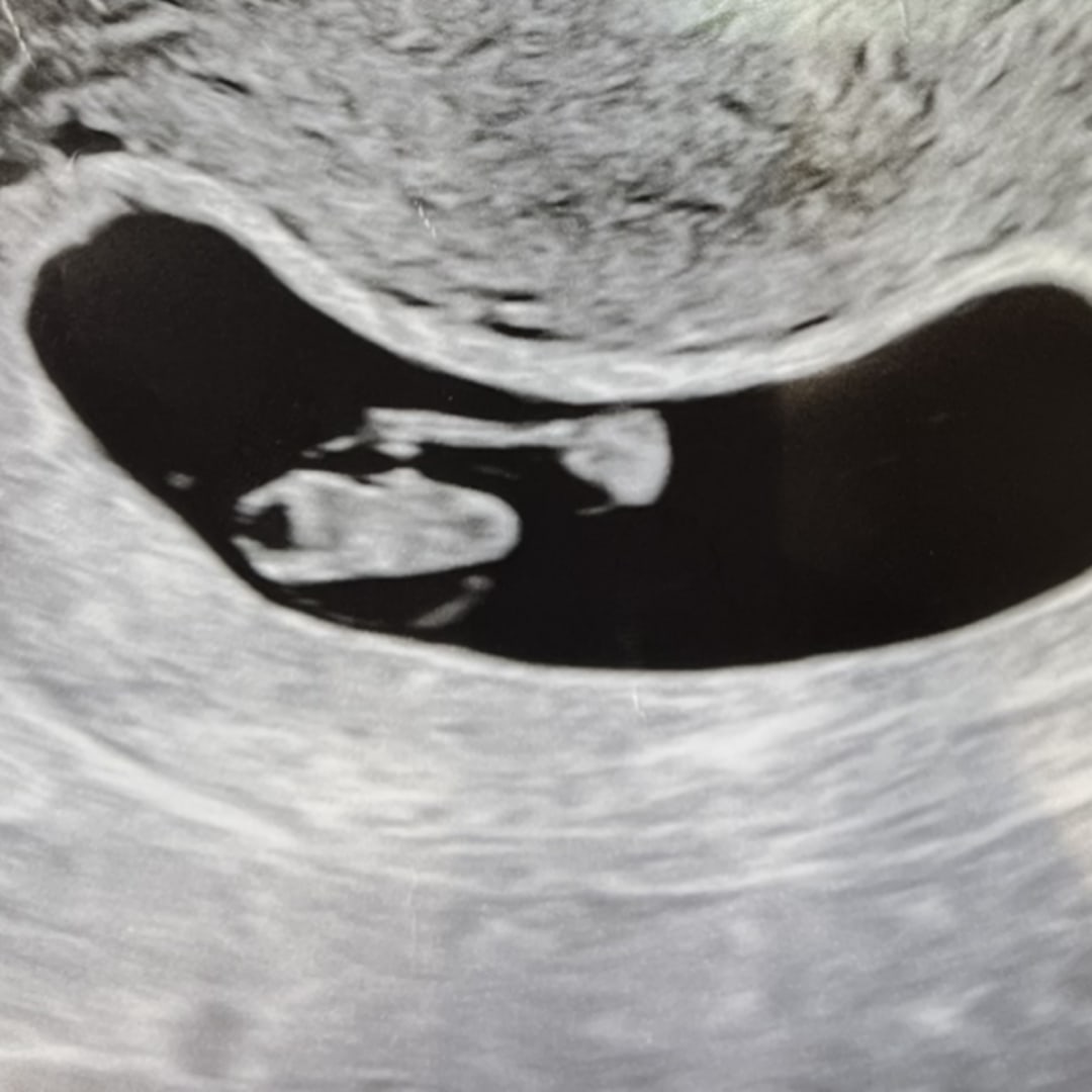 Photo shared by Claire for their Babylist baby registry.