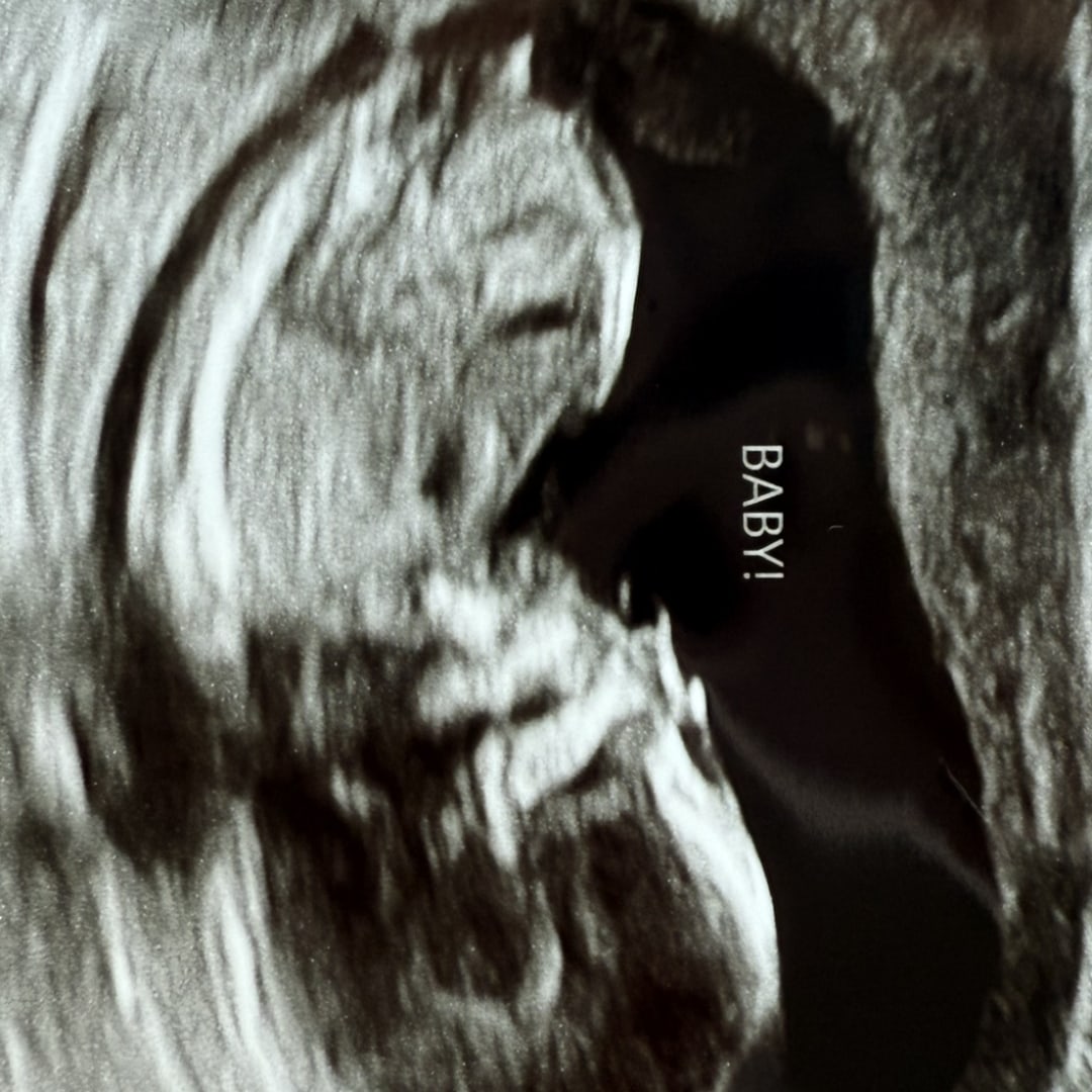 Photo shared by Brandon for their Babylist baby registry.