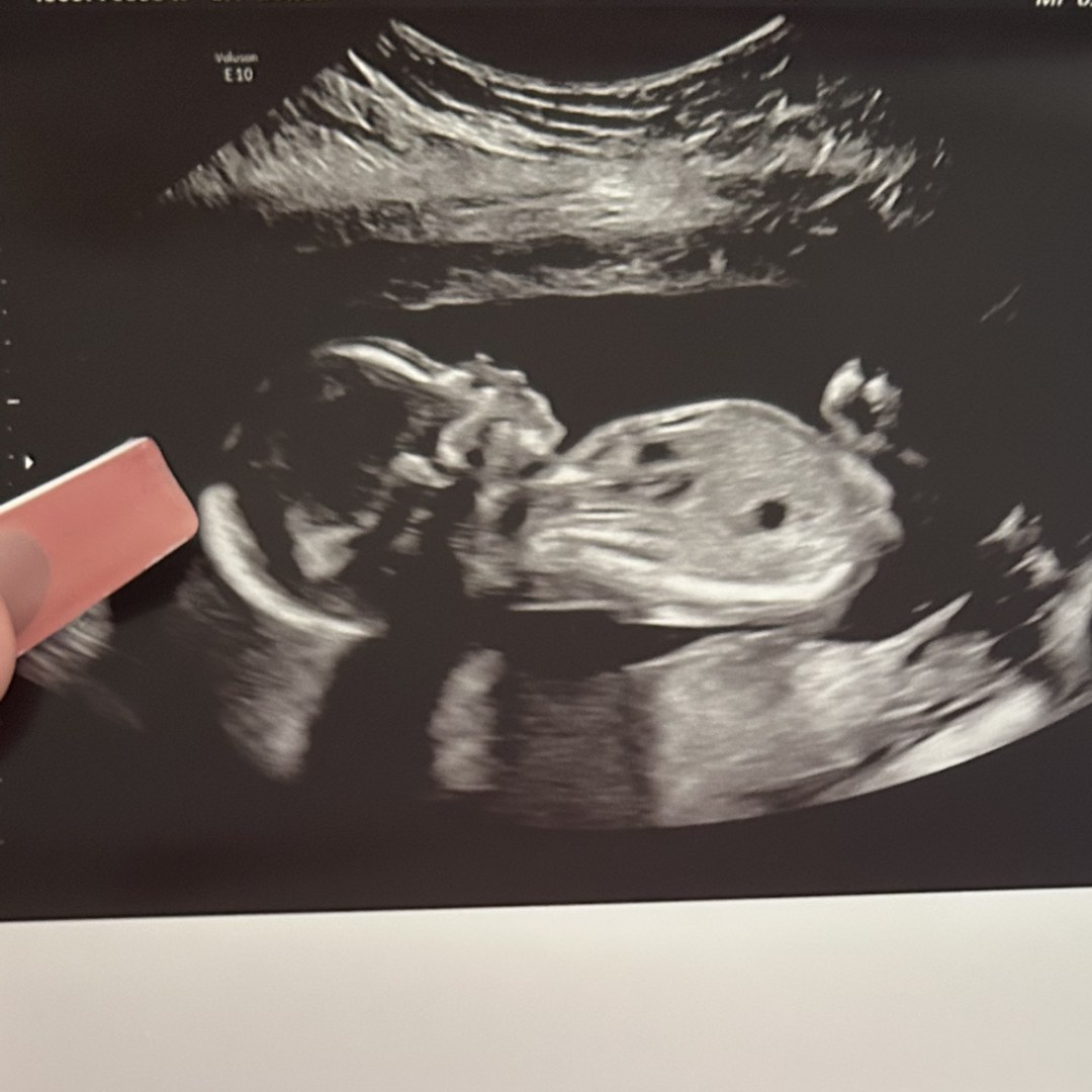 Photo shared by Jaylon for their Babylist baby registry.