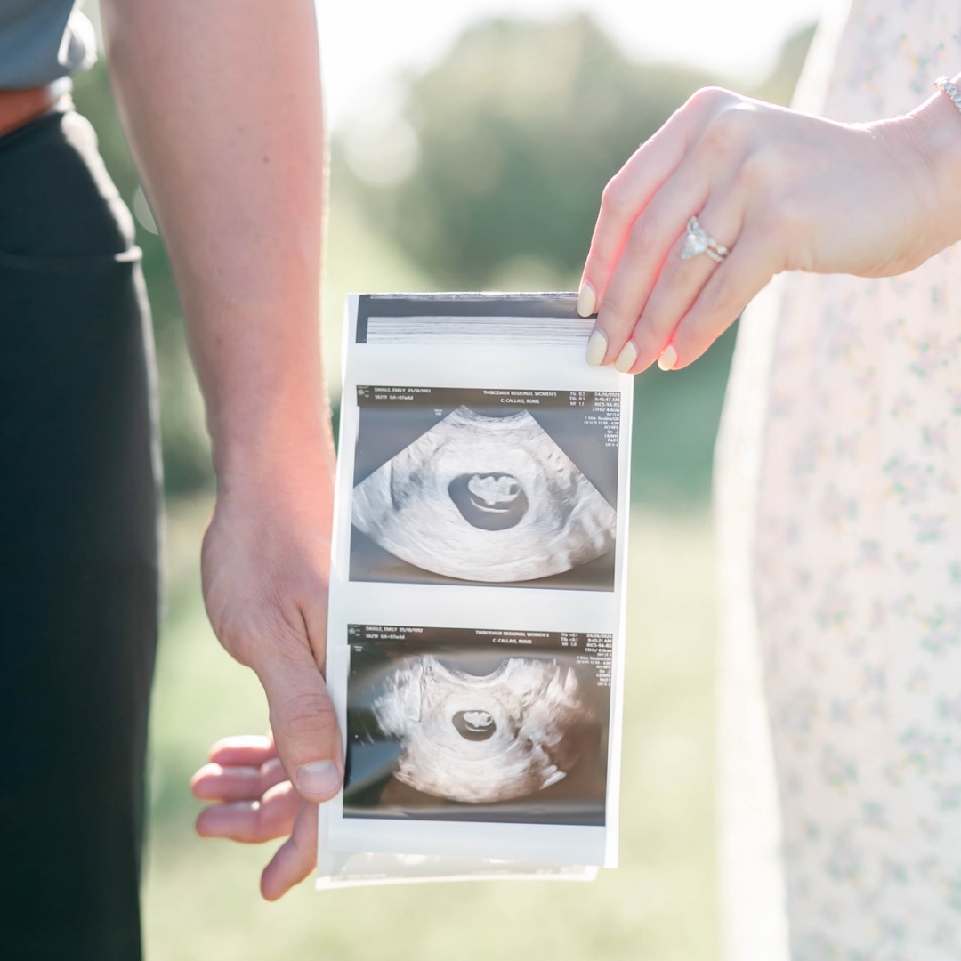 Photo shared by Emily for their Babylist baby registry.