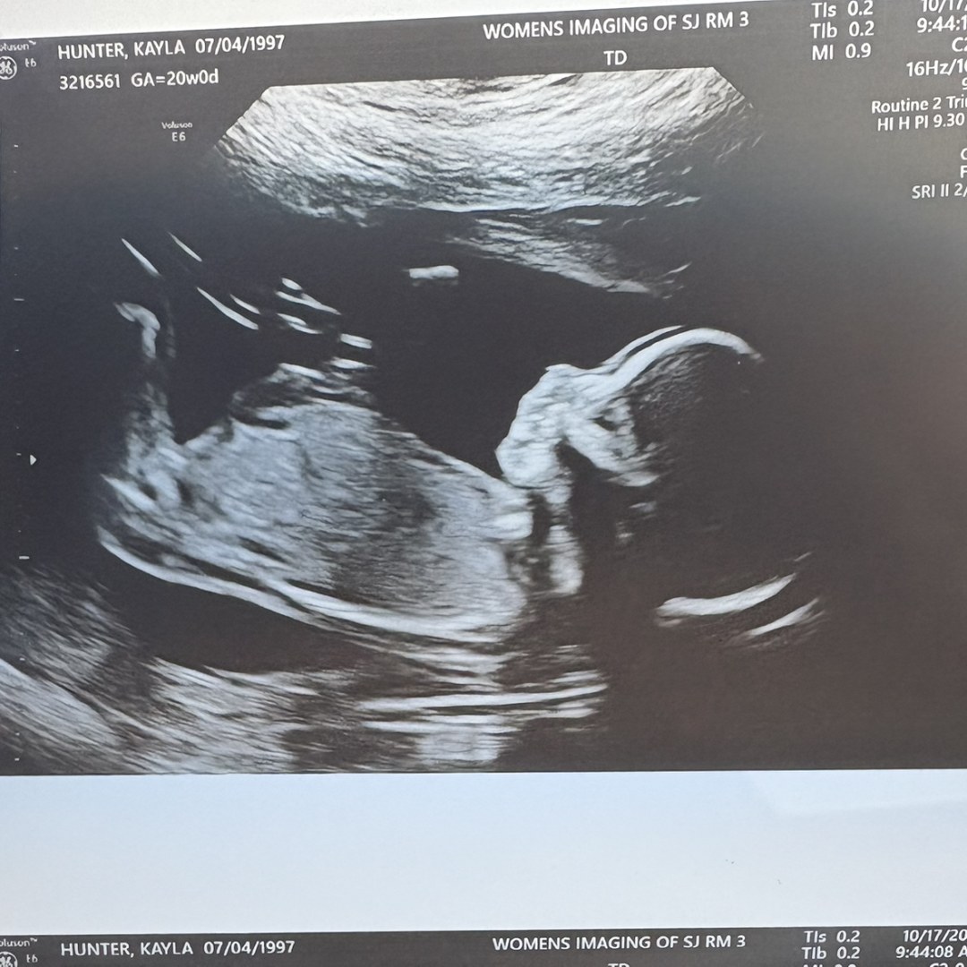 Photo shared by Kayla for their Babylist baby registry.