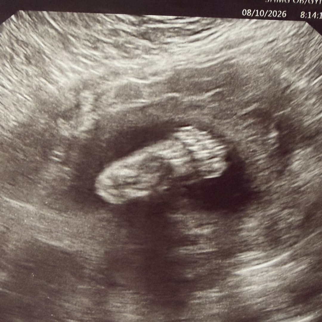Photo shared by Aalicyah for their Babylist baby registry.