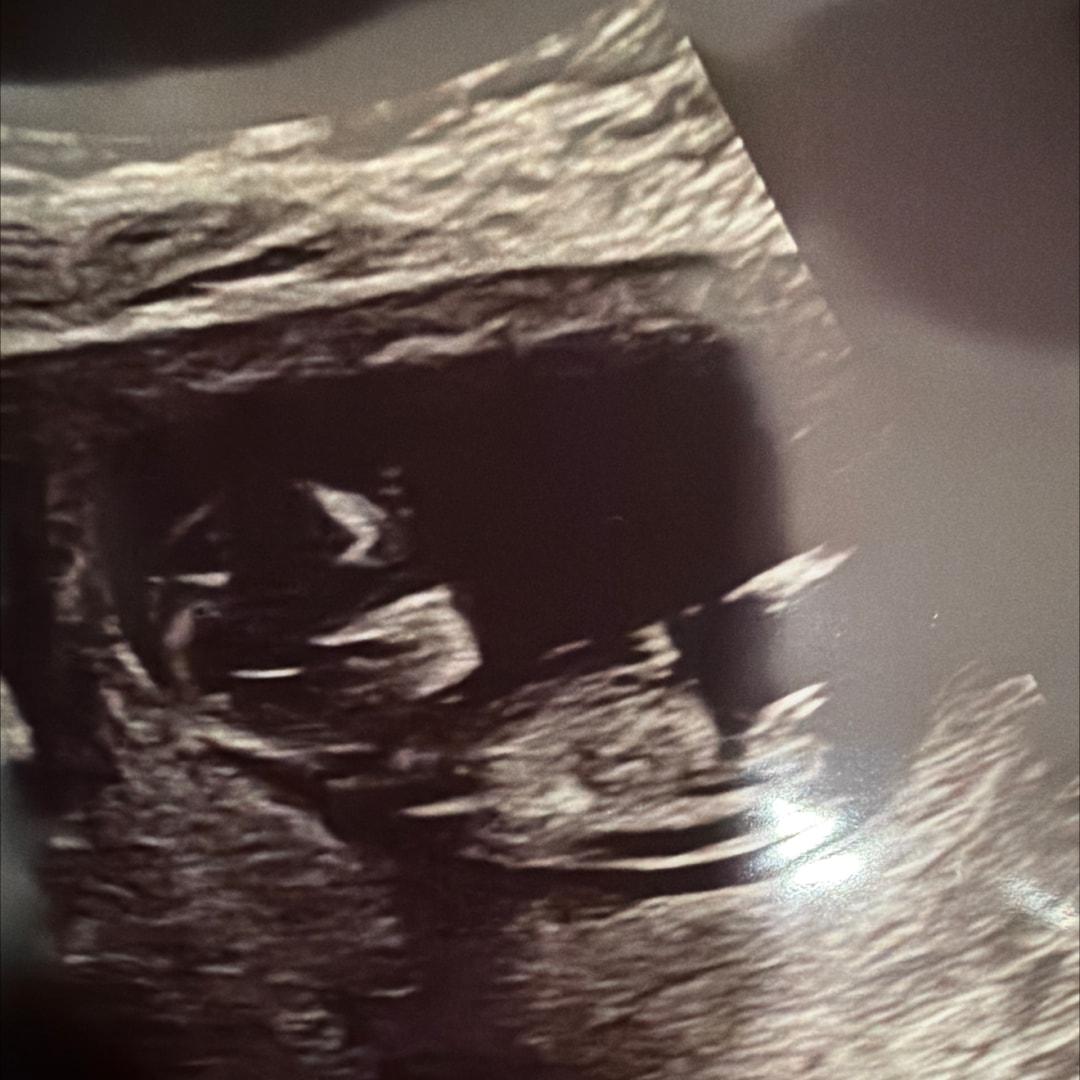 Photo shared by Colin for their Babylist baby registry.