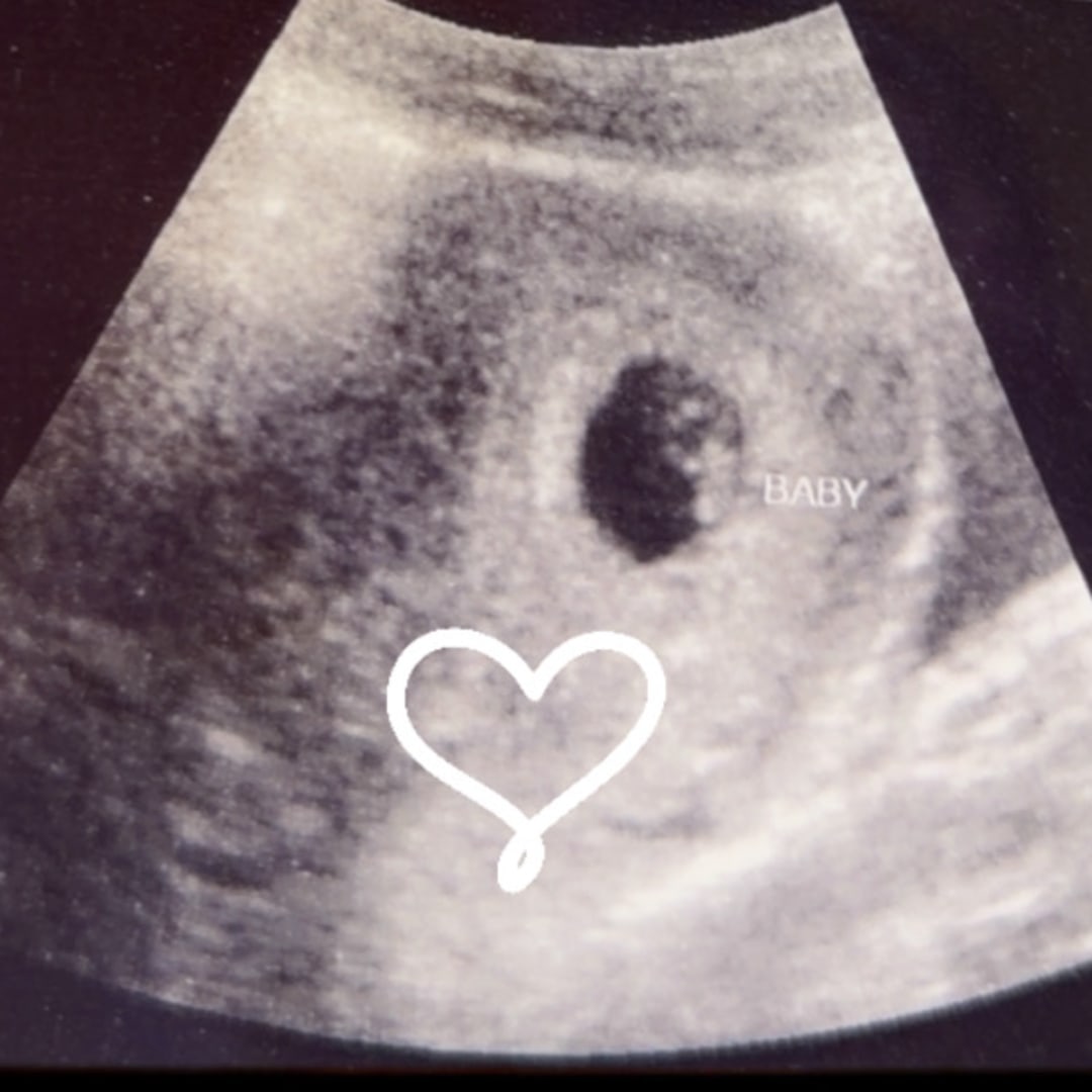 Photo shared by Mackenzie for their Babylist baby registry.