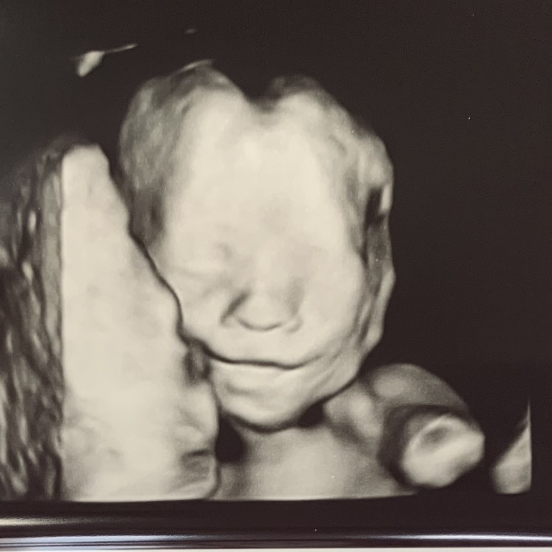 Photo shared by Emma for their Babylist baby registry.