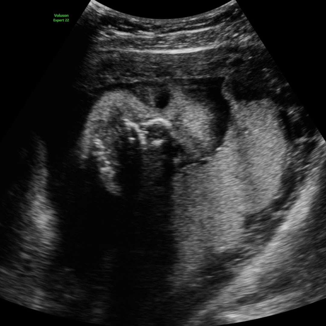 Photo shared by Abriana for their Babylist baby registry.